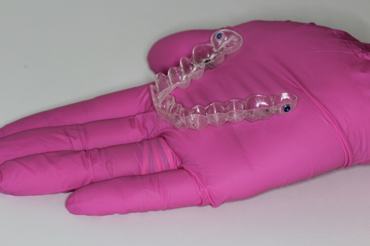 Invisalign alinhador transparente para crianças Invisalign alinhador transparente para crianças