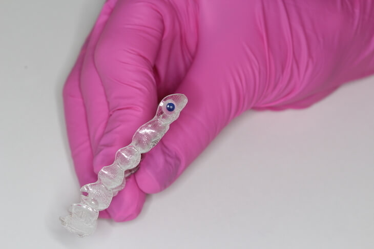 Invisalign alinhador transparente para crianças Invisalign alinhador transparente para crianças