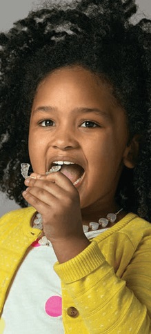 Invisalign alinhador transparente para crianças Invisalign alinhador transparente para crianças