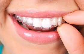 Harmonização Orofacial Harmonização Orofacial