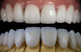 Harmonização Orofacial Harmonização Orofacial